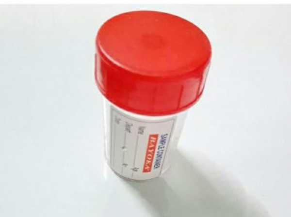 Vi sinh xử lý nước thải bể kỵ khí UASB
