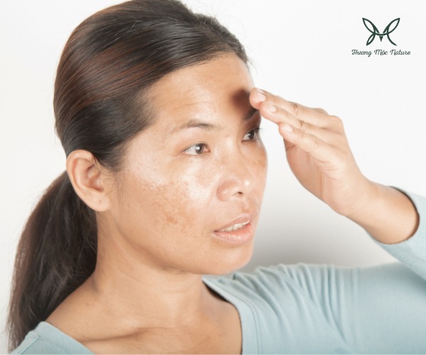 Gia công kem chống nắng cho bà bầu