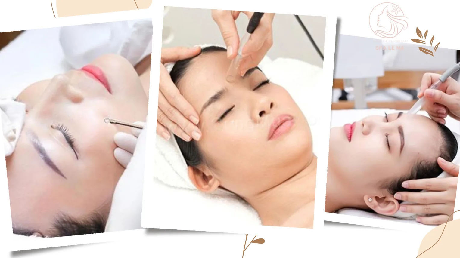 Lấy nhân mụn