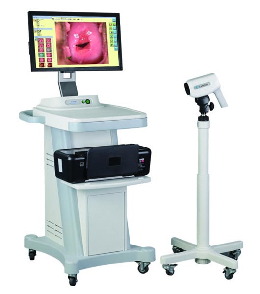 Máy soi cổ tử cung LT 300