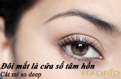 Thẩm mỹ mắt