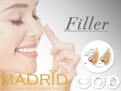 Tiêm filler nâng mũi