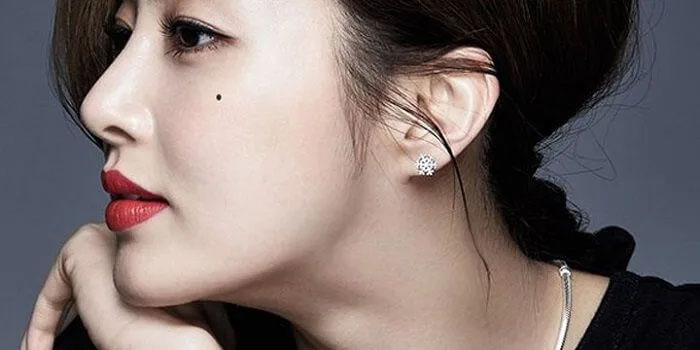 Xóa nốt ruồi