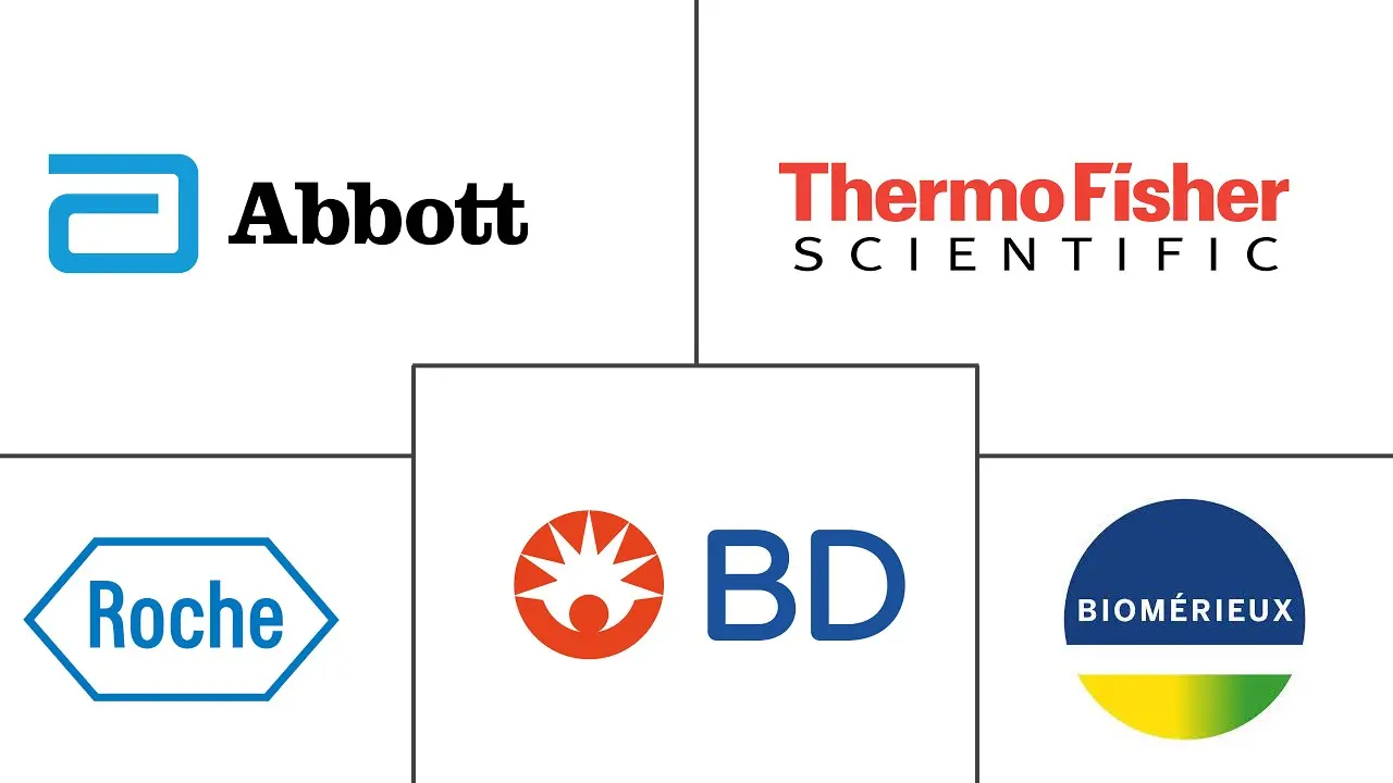 呼吸道合胞病毒 (RSV) 诊断市场规模和份额