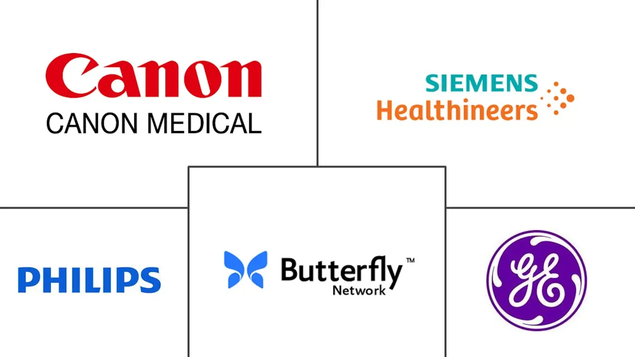 便携式超声设备市场规模和份额